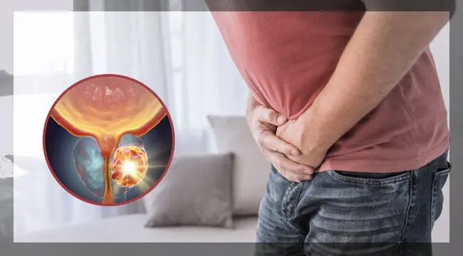 علاقة التهاب البروستاتا وضعف الانتصاب