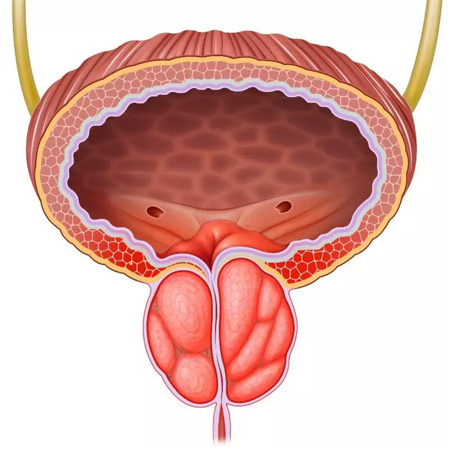 التهاب البروستاتا والانتصاب